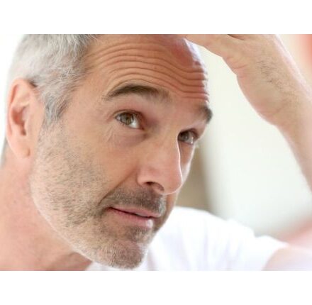 Как предотвратить выпадение волос у мужчин?